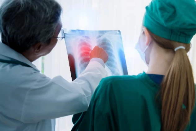 Akciğer Kanseri ve Göğüs Cerrahisi: Tanı, Tedavi ve İlerlemeler