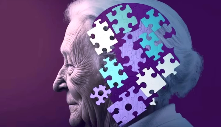 Alzheimer's Disease: Losing Time as the Brain Deteriorates
