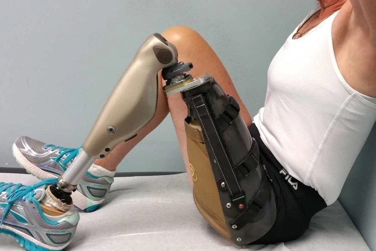 What is Prosthetic Leg? What are the types?