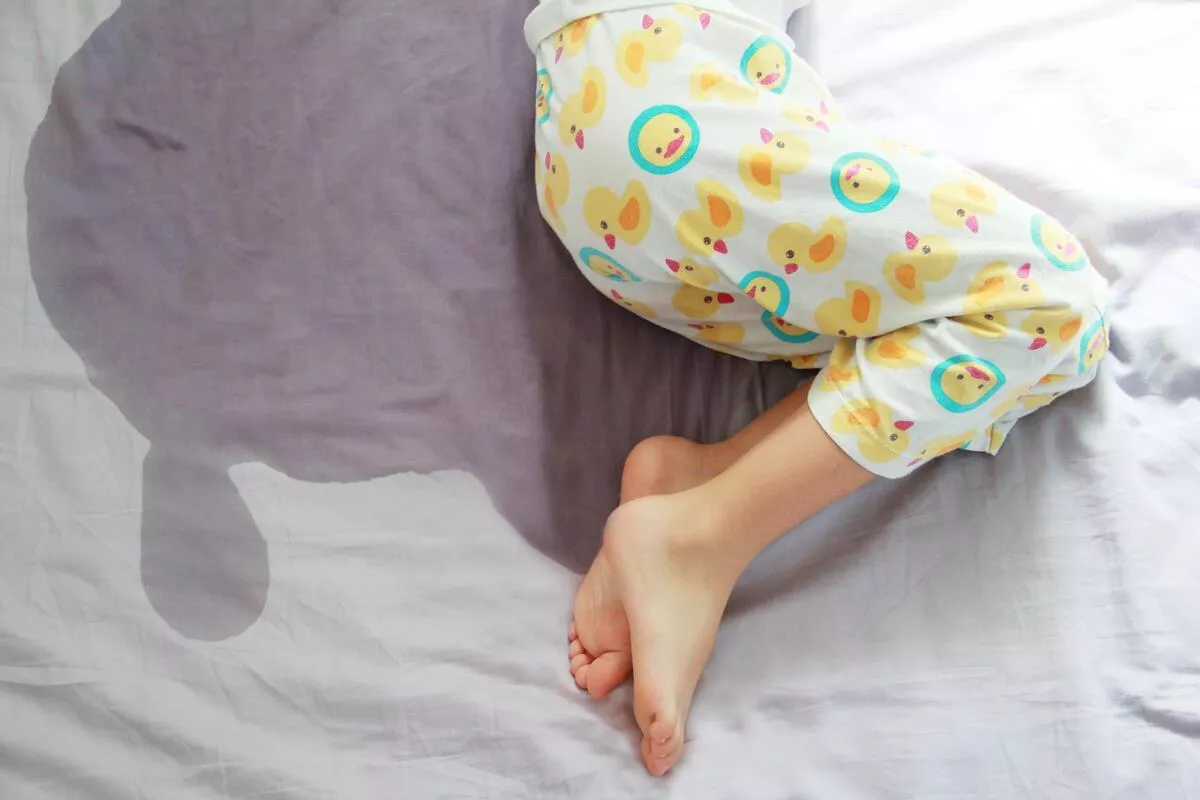 Bedwetting Problem in Children (Enuresis)