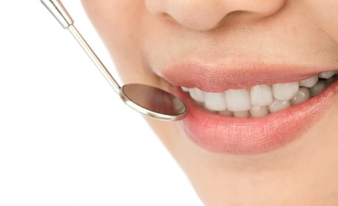 Teeth Whitening Procedures: Add Sparkle to Your Smile