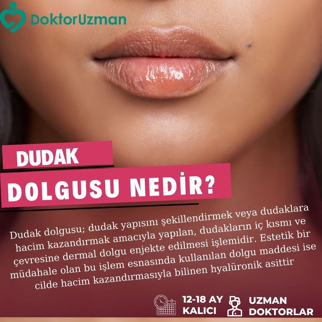 Dudak Dolgusu Nedir?