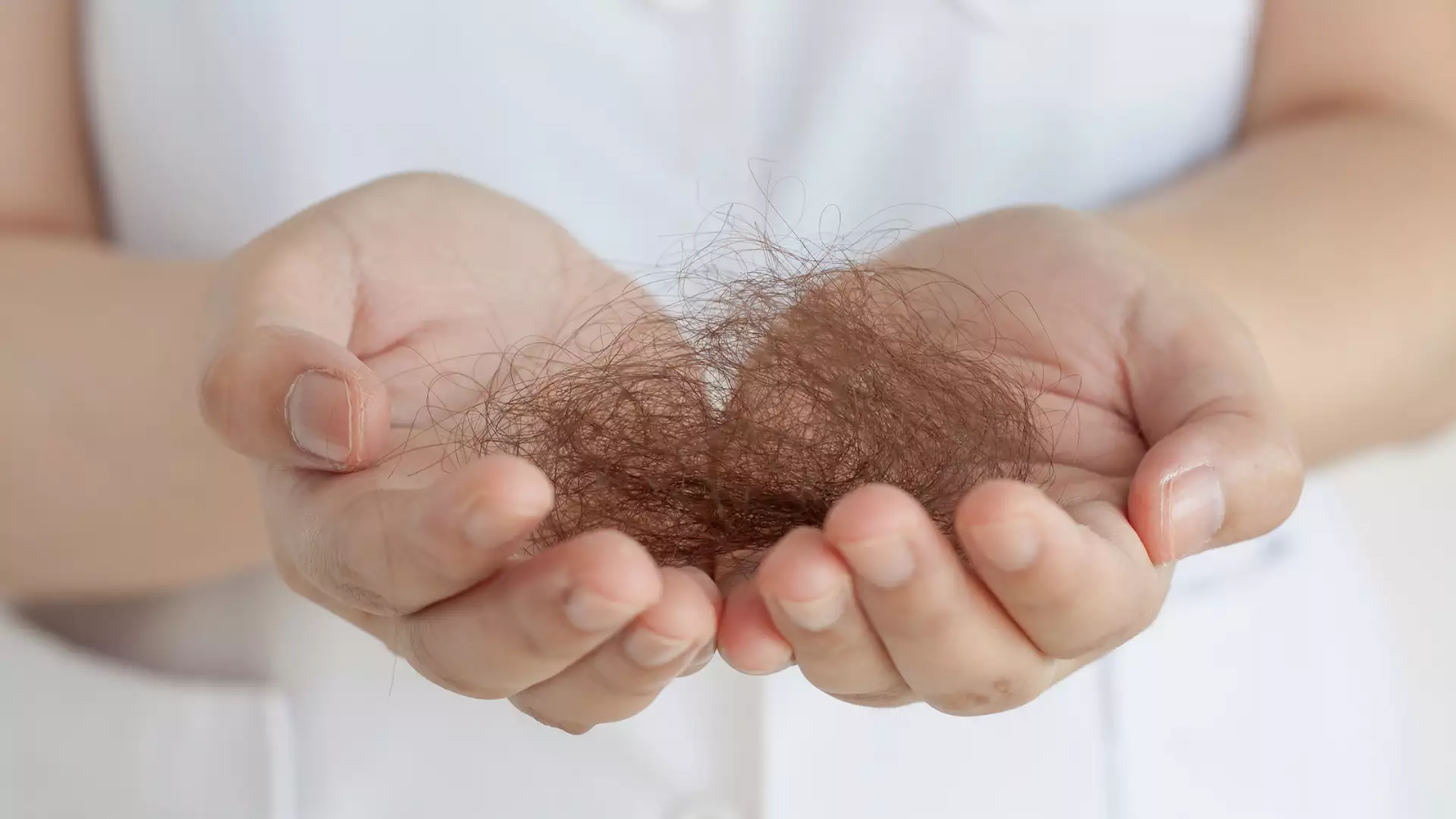 Hair Loss Treatment in Men and Women