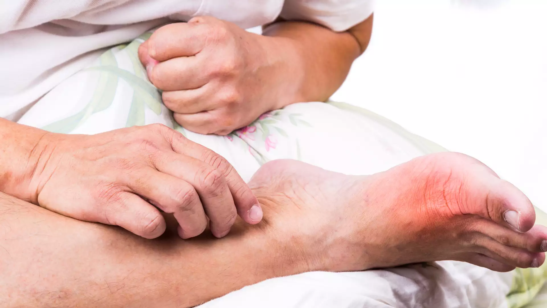 What is gout? What are the Symptoms and Treatment Methods?