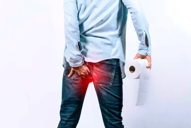 Laser Applications in the Treatment of Hemorrhoids