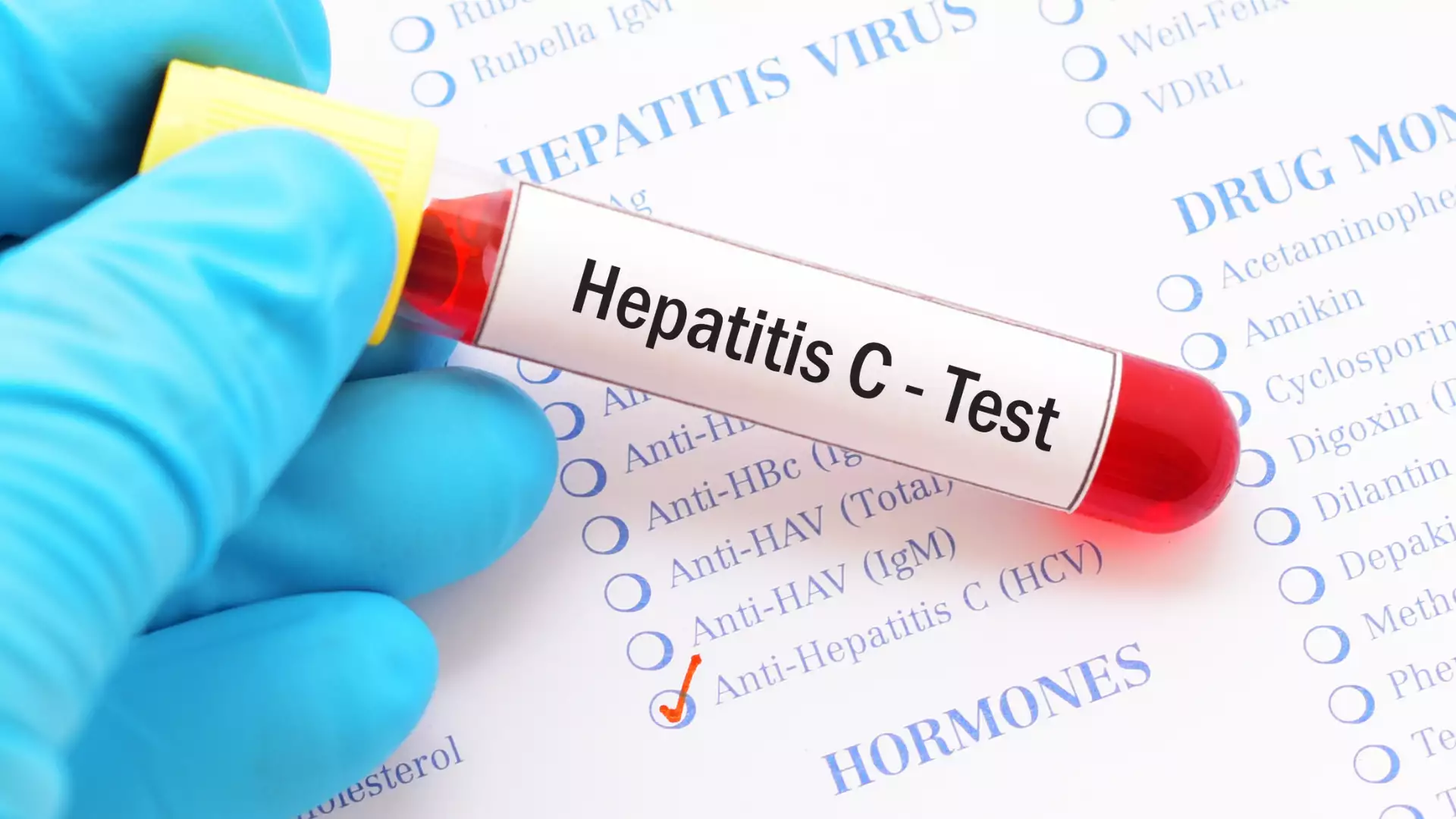 What is Hepatitis C?