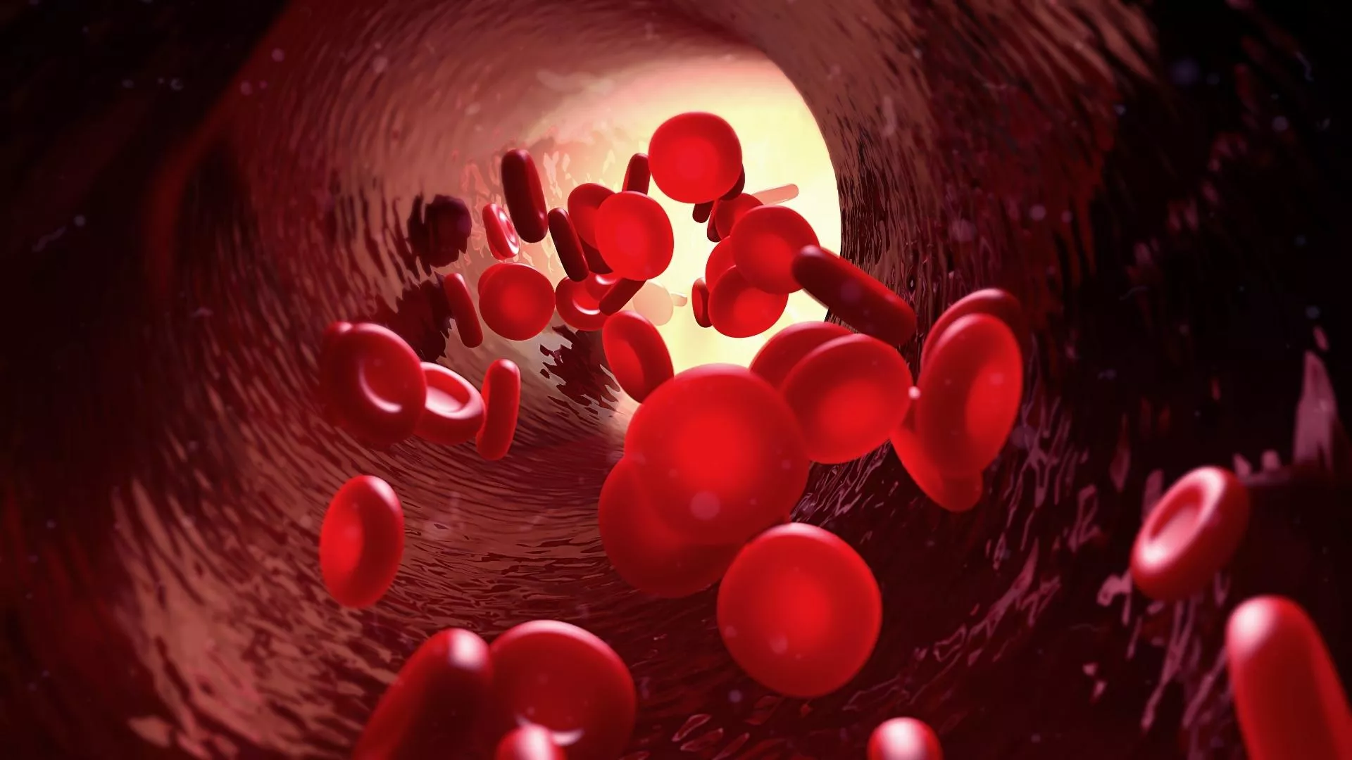 How Should Diet for Anemia?