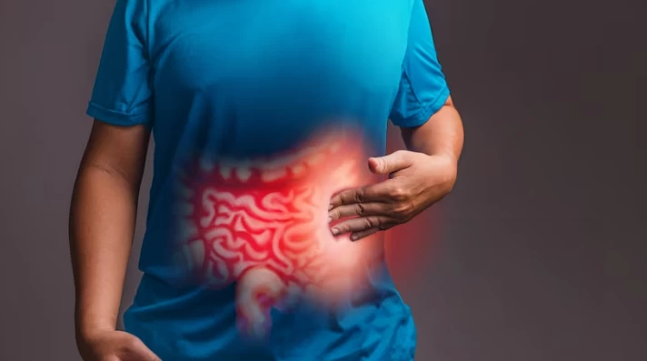Who is at Risk for Colon Cancer?