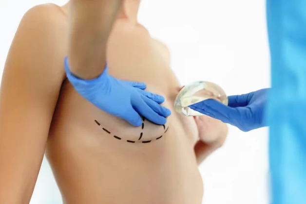 Breast Aesthetic Surgeries Reshaping for Beauty and Confidence