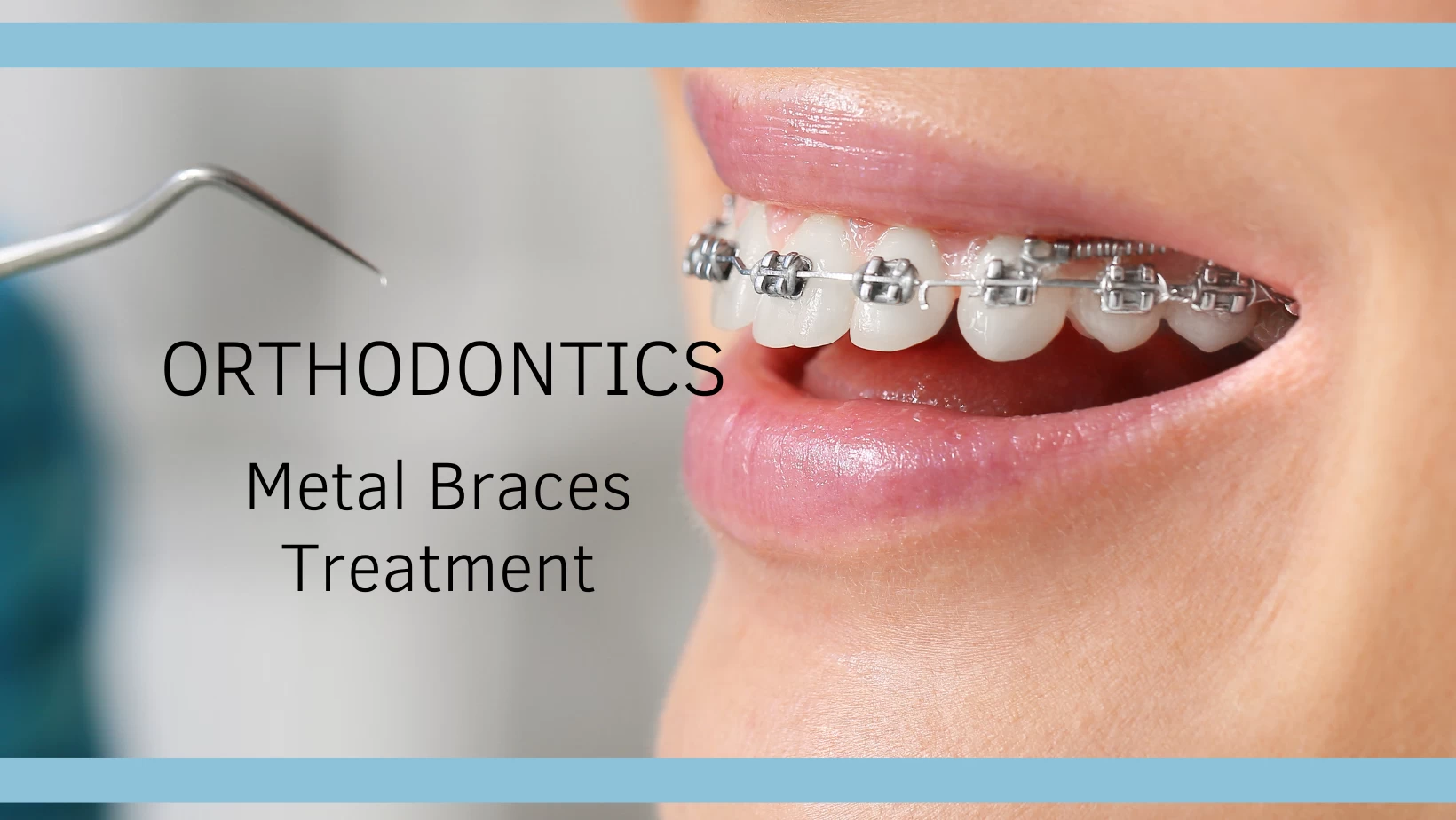 How are Metal Braces Treatment Made?