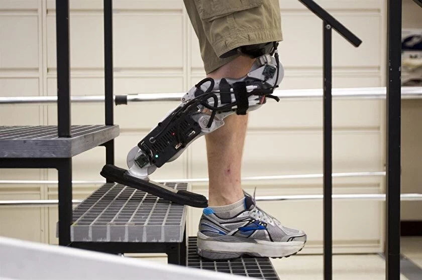 What are the Prosthesis Types? What Are They Used For?