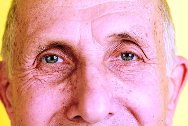 Sarı Nokta Hastalığı