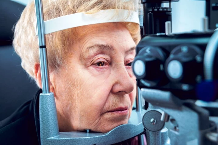 Macular Degeneration: Retinal Disease and Vision Loss