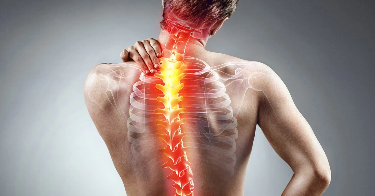 Scoliosis Diseases and Treatment Methods