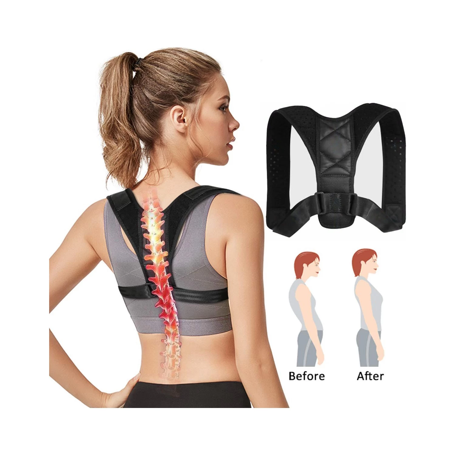 Things to Know About Scoliosis Corset