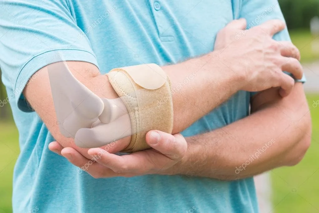 Tennis Elbow: Does It Cause Weakness in the Fingers and Hands?