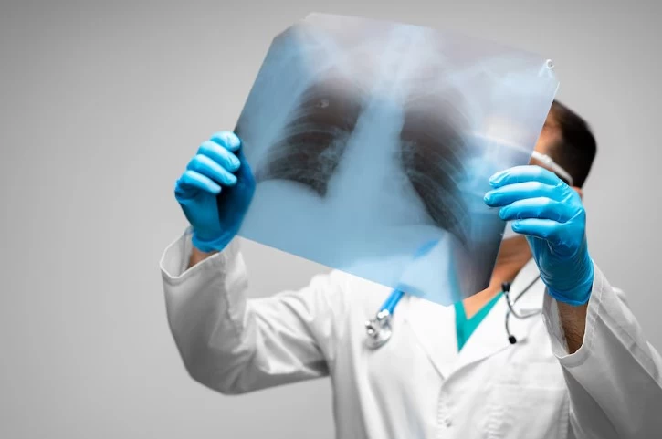 Pneumonia: The Silent Enemy of the Lungs