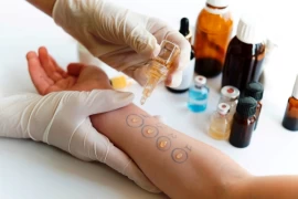 Allergy Skin Prick Test doktoruzman