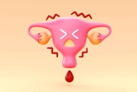 Abnormal Uterine Bleeding