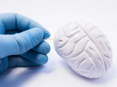 What is Brain Tumor? doktoruzman