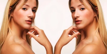 Estetik Burun Cerrahisi (Rinoplasti)