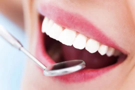 What is Dental Veneers? doktoruzman