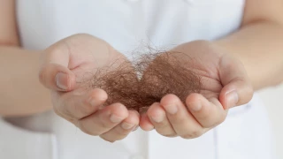 Hair Loss Treatment in Men and Women doktoruzman