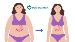 Bariatrik Cerrahi doktoruzman