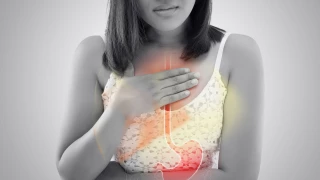 Gastrit Nedir? Gastrit Belirtileri Nelerdir? Gastrite Neden Olan Etkenler Nelerdir? doktoruzman
