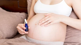 What should be done to avoid stretch marks during pregnancy? doktoruzman