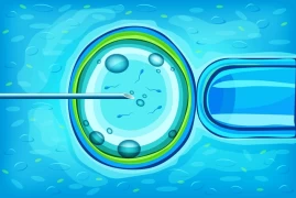 Artificial Insemination Method in Female Infertility