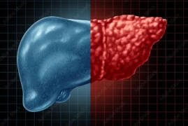 Non-Alcoholic Fatty Liver Disease (Non-Alcoholic Steatohepatitis)