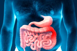 Colon Cancer - Part 1: Incidence, Symptoms, Risk Factors