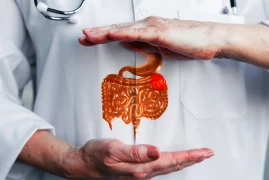 Colon Cancer - Part 2: Diagnosis and Treatment Methods