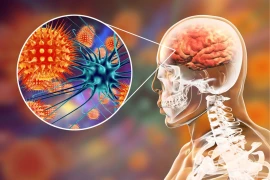 What is Meningitis? How It Is Transmitted, Meningitis Symptoms and Treatment