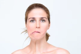 What is Moebius Syndrome, What Are Its Symptoms, How Is It Diagnosed?