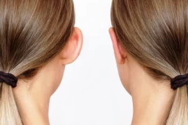 Otoplasty: Expert Touches to Enhance Ear Beauty doktoruzman