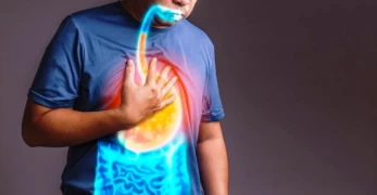Gastroesophageal Reflux Disease - Part 1: Formation, Frequency, Diagnosis doktoruzman