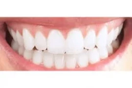 How Should a Healthy Gum Be? doktoruzman