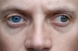 Strabismus: Perspective of an Ophthalmologist doktoruzman