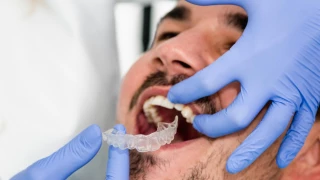 What is Transparent Plaque? doktoruzman