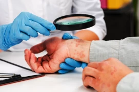 Scabies: Diagnosis, Treatment, and Prevention