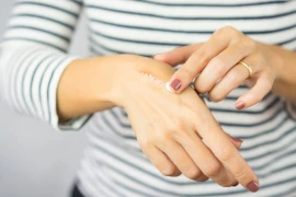Yanık Nedir? doktoruzman
